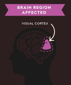 The visual cortex.